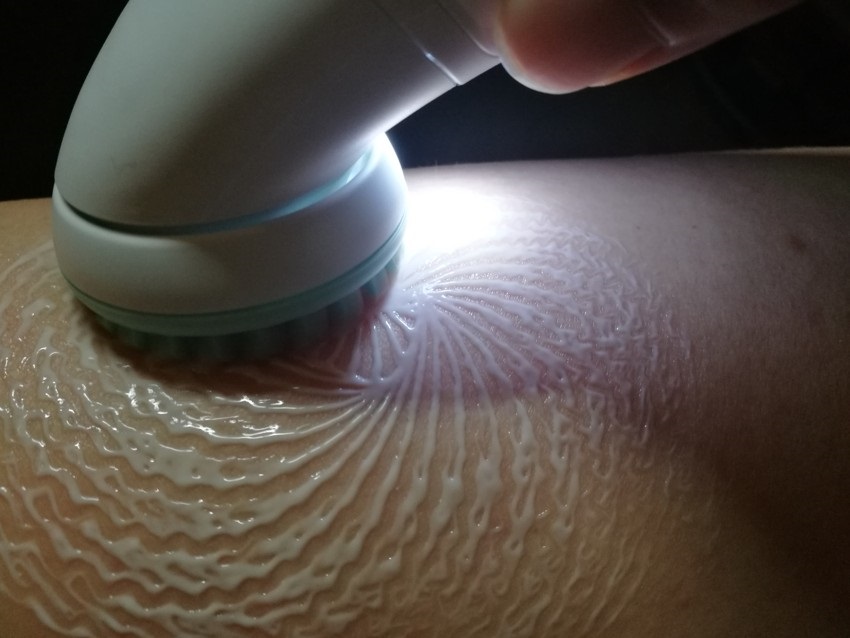 Braun Silk-epil SensoSmart 9-990 – masážne hlavice